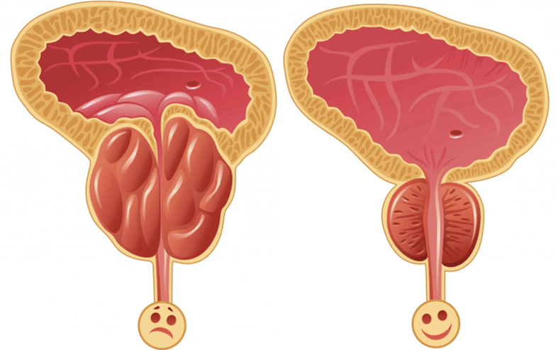 прычыны ўзнікнення праблем з патэнцыяй у мужчын